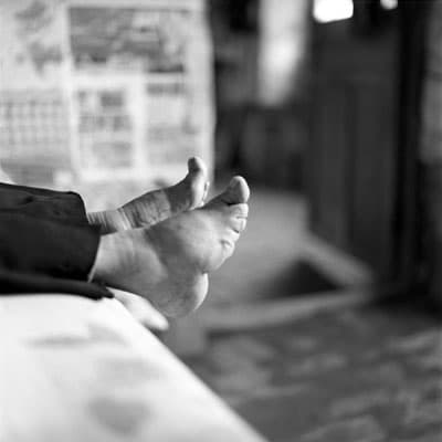 Bound Feet, a photographic report on these Chinese women with bound feet